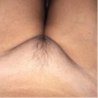_curthun avatar