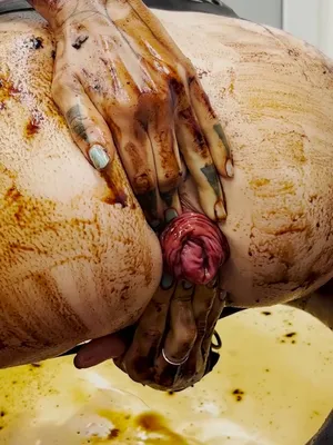 #Perverse #Extreme #Prolapse #Power Fetish.com #Vertical Porn