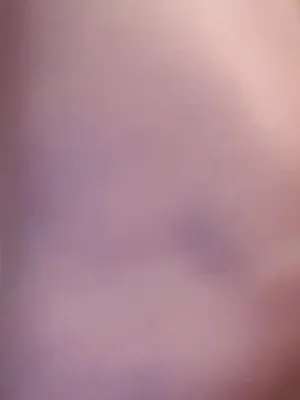 Short XFree