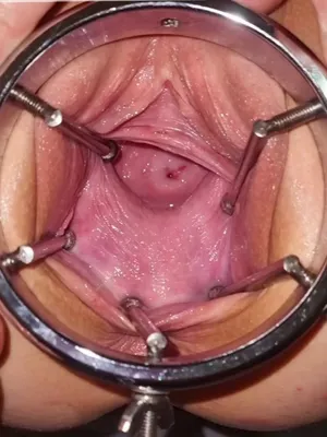 #Fisting #Gyno #Gaping Hole #Vertical Porn