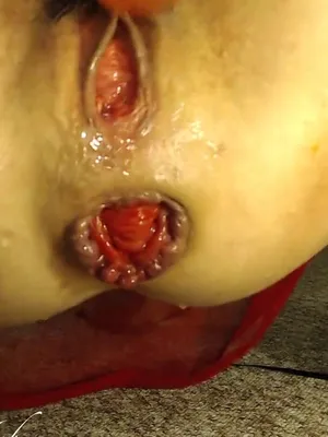 #Rough #Extreme #Webcam #Kink #Solo Masturbation #Vertical Porn #Prolapse Squirt #Ruined Asshole