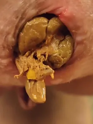 #Scat