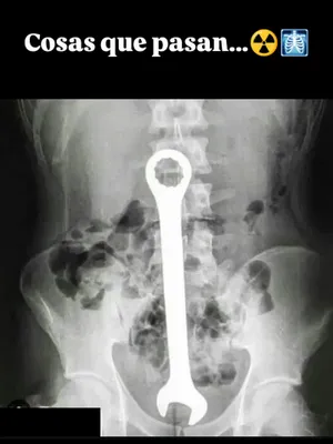 #Funny #Vertical Porn #Leaks #Xray
